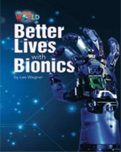Better lives with bionics