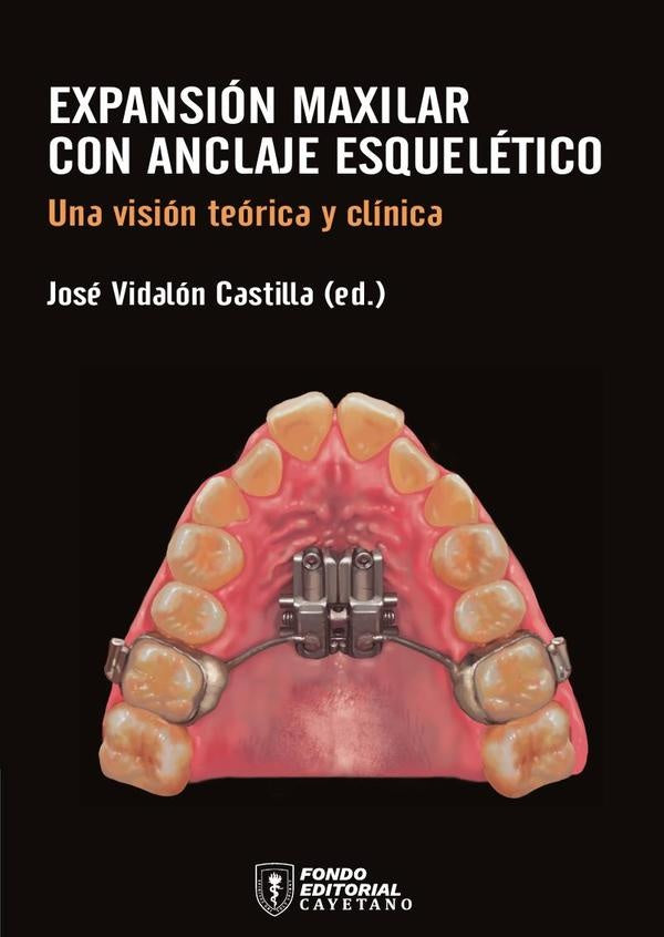 Expansión maxilar con anclaje esquelético | José Antonio  Vidalón Castilla