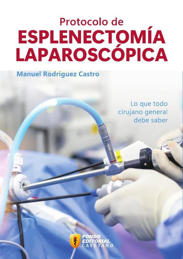 Protocolo de esplenectomía laparoscópica | Manuel Rodríguez Castro