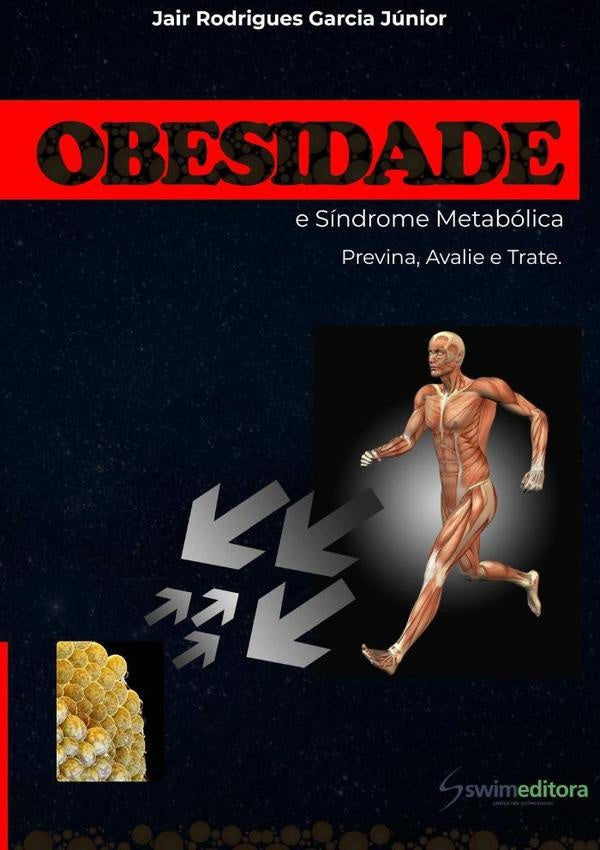 Obesidade E Síndrome Metabólica | Jair Rodrigues Garcia Júnior