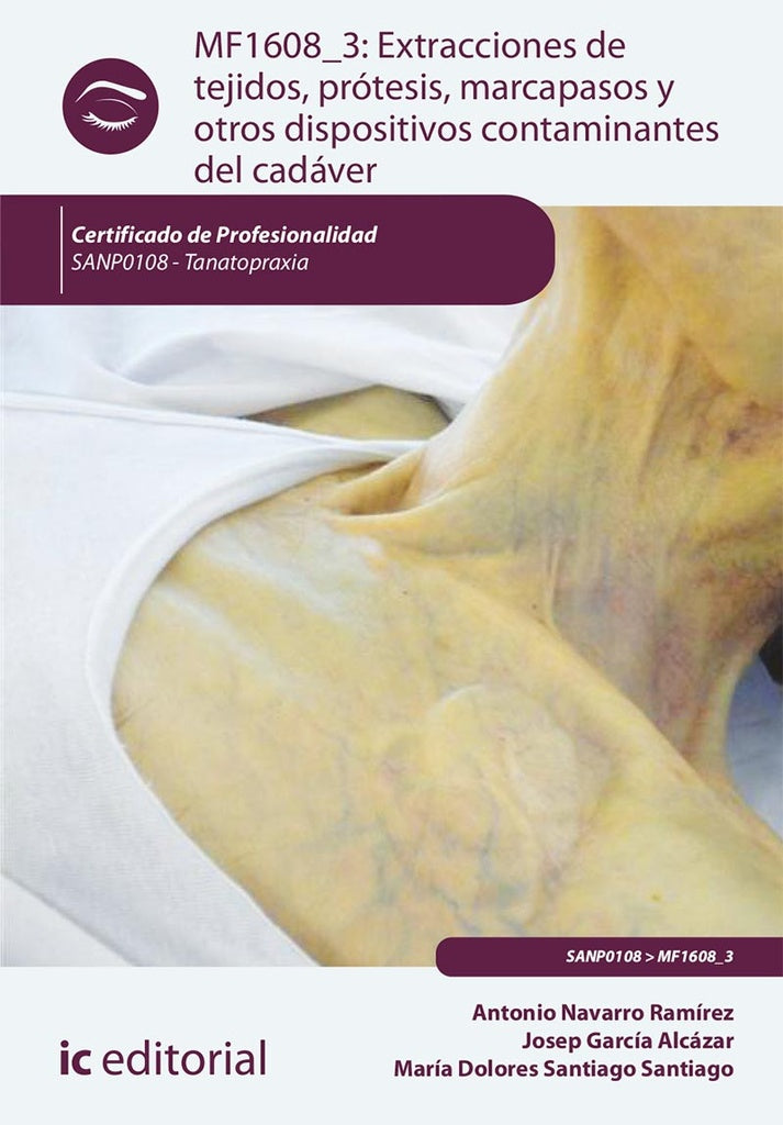 Extracciones de tejidos, prótesis, marcapasos y otros dispositivos contaminantes del cadáver. SANP01 | Navarro Ramírez, Santiago Santiago y otros