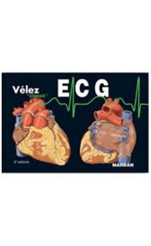 E.C.G. ELECTROCARDIOGRAFIA | Luis Vélez