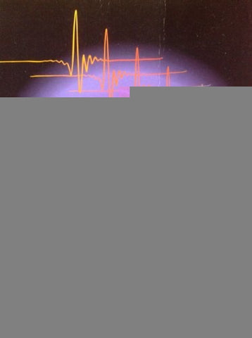 Analisis Instrumental | Skoog