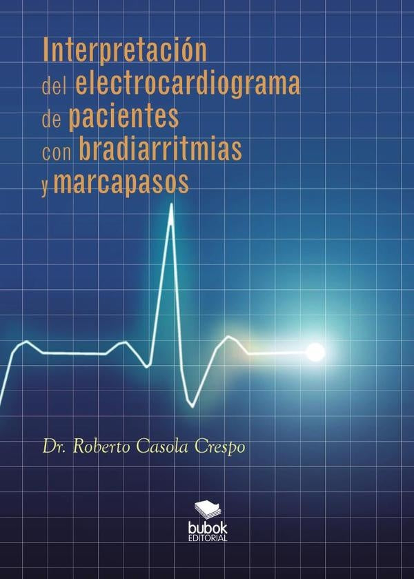 Interpretación del electrocardiograma de pacientes con bradiarritmias y marcapasos | Roberto Casola