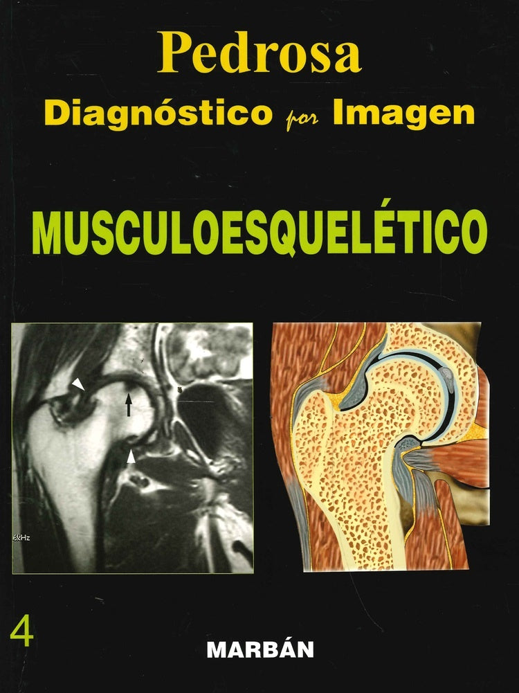 MUSCULOESQUELETICO 4.. | PEDROSA