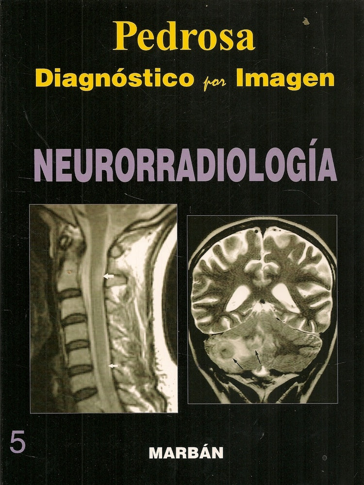 NEURORRADIOLOGÍA VOL.5 DIAGNÓSTICO POR IMAGEN.. | PEDROSA
