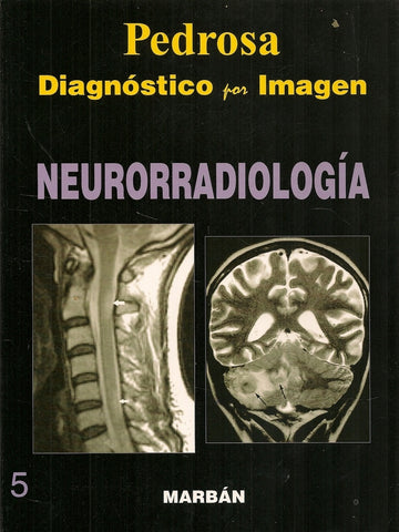 NEURORRADIOLOGÍA VOL.5 DIAGNÓSTICO POR IMAGEN.. | PEDROSA