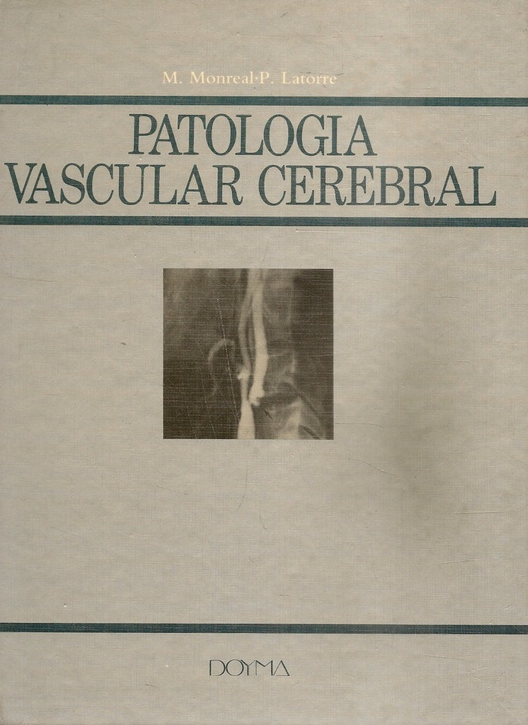 PATOLOGIA VASCULAR CEREBRAL.. | M MONREAL