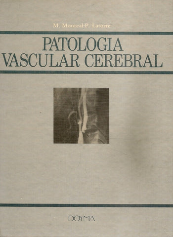PATOLOGIA VASCULAR CEREBRAL.. | M MONREAL