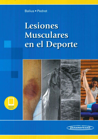 LESIONES MUSCULARES EN EL DEPORTE.. | Ramon Balius  Matas