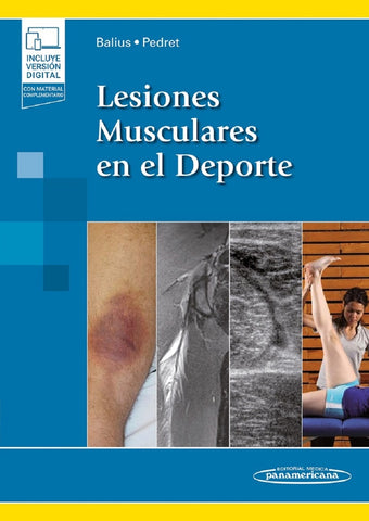 LESIONES MUSCULARES EN EL DEPORTE.. | Ramon Balius  Matas