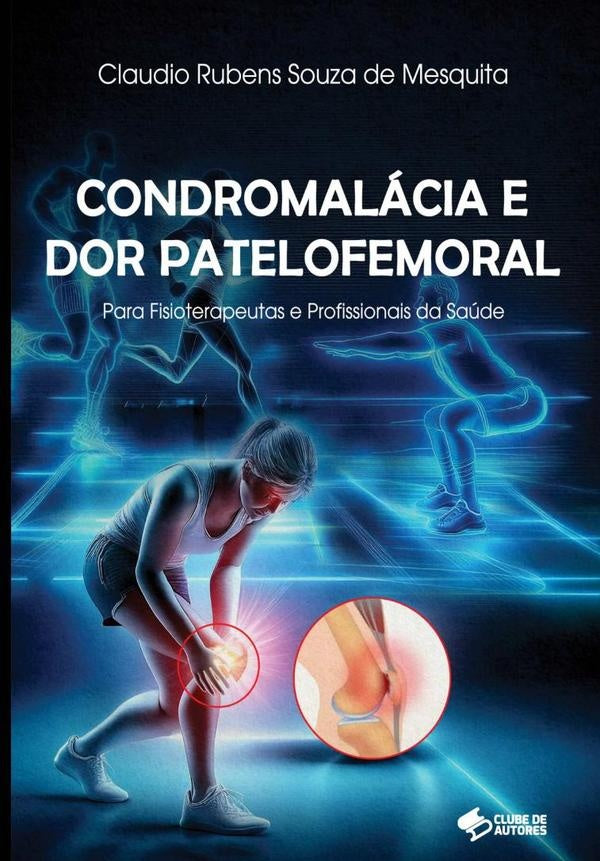 Condromalácia E Dor Patelofemoral | Claudio Rubens Souza De Mesquita