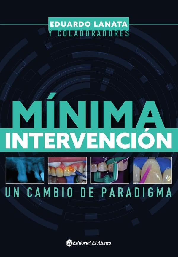 Mínima intervención | Eduardo Lanata