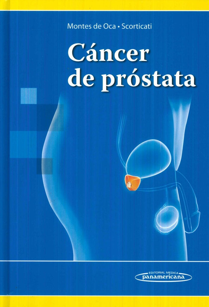 CANCER DE PROSTATA.. | MONTES DE OCA