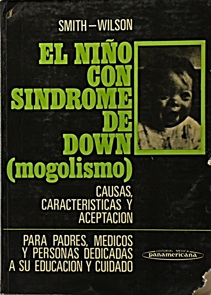 EL NIÑO CON SINDROME DE DOWN (MOGOLISMO).. | David W. Smith