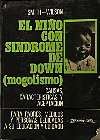 EL NIÑO CON SINDROME DE DOWN (MOGOLISMO).. | David W. Smith