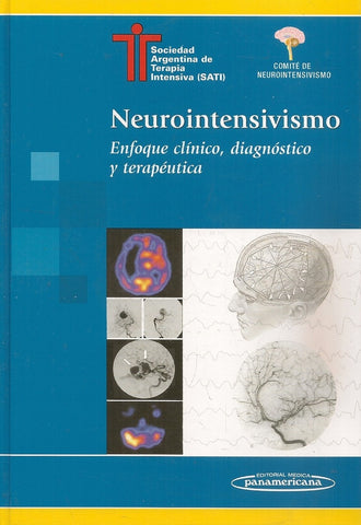 NEUROINTENSIVISMO: ENFOQUE CLINICO, DIAGNOSTICO Y TERAPEUTICA