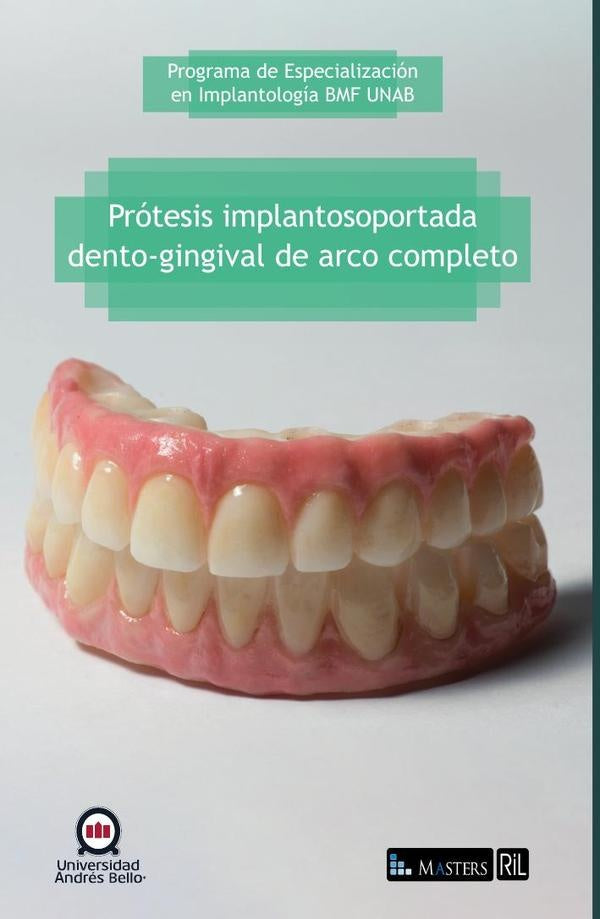 Prótesis implantosoportada dento-gingival de arco completo | Programa de Especialización
