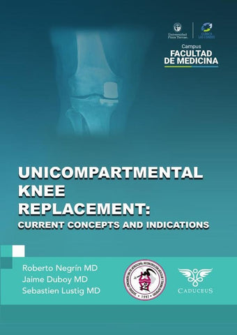 Unicompartmental knee replacement | Roberto  Negrín Vyhmeister