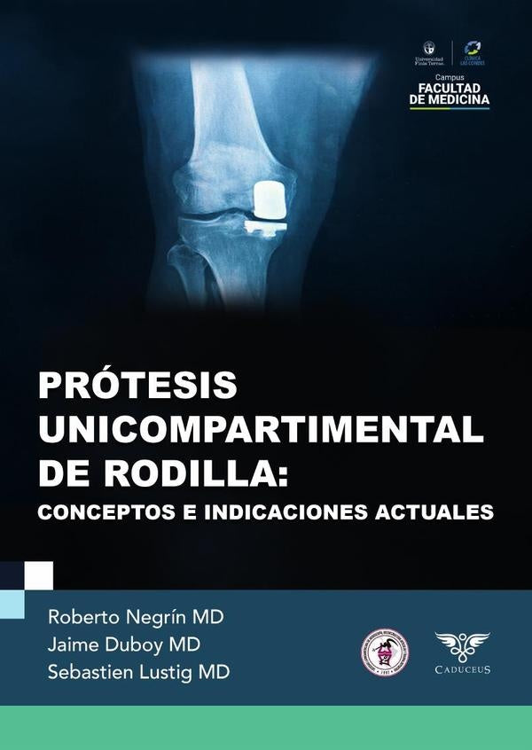 Prótesis unicompartimental de rodilla | Roberto Negrín