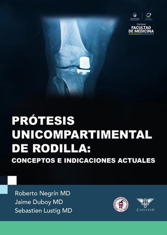 Prótesis unicompartimental de rodilla | Roberto Negrín