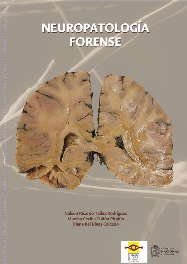 Neuropatología forense | Tuñón Pitalúa, Tellez
