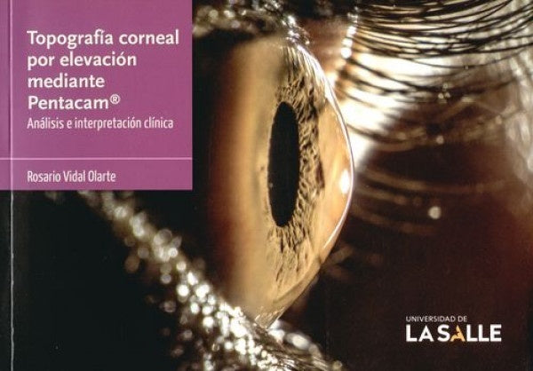 Topografía corneal por elevación mediante Pentacam® | Rosario Vidal Olarte