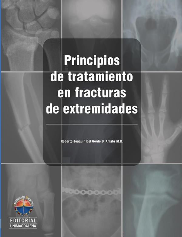 Principios de tratamiento en fracturas de extremidades | Roberto Joaquín Del Gordo D´Amado
