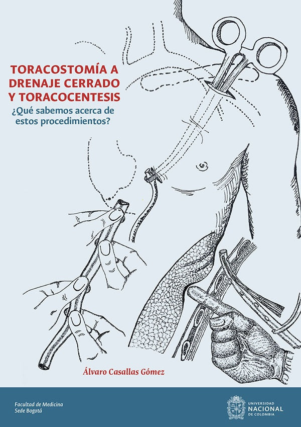 Toracostomía a drenaje cerrado y toracocentesis | Álvaro Casallas Gómez