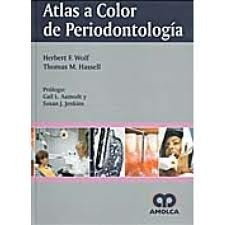 Atlas a Color de Periodontolgia  | Herbert F. Wolf