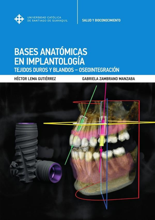 Bases anatómicas en implantología : tejidos duros y blandos - oseointegración | Zambrano Manzaba, Lema Gutiérrez