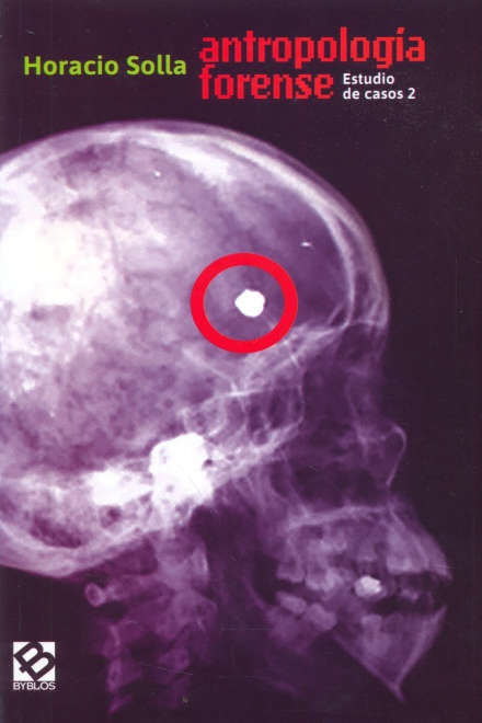 ANTROPOLOGÍA FORENSE.. | Horacio Solla