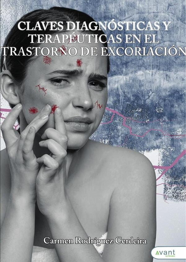 Claves diagnósticas y terapéuticas en el trastorno de excoriación  | Carmen Rodríguez Cerdeira