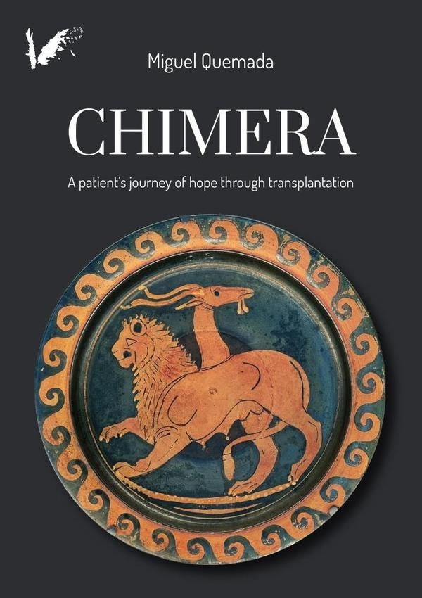 Chimera | Miguel Quemada Sáenz-Badillos